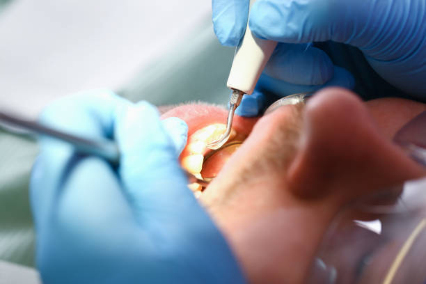 Best Broken Tooth Emergency  in Lake Cherokee, TX