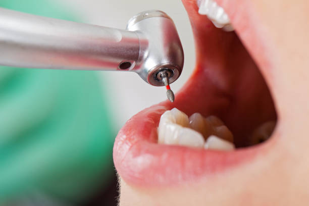 Best Emergency Dentist Near Me  in Lake Cherokee, TX
